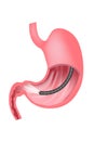 gastroscopy. Endoscopic examination of the stomach.